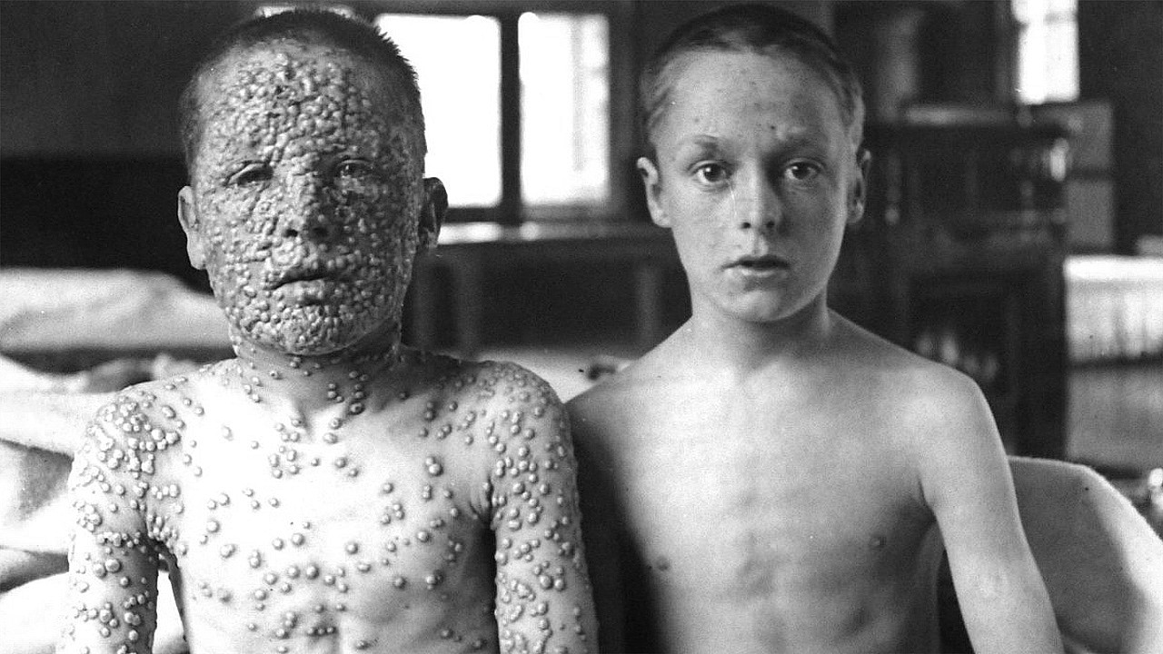 Outbreak: Anatomy of a Plague Background